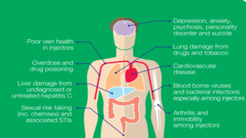 Health related issue - drugs